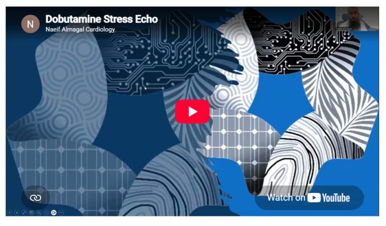 Dobutamine Stress Echo